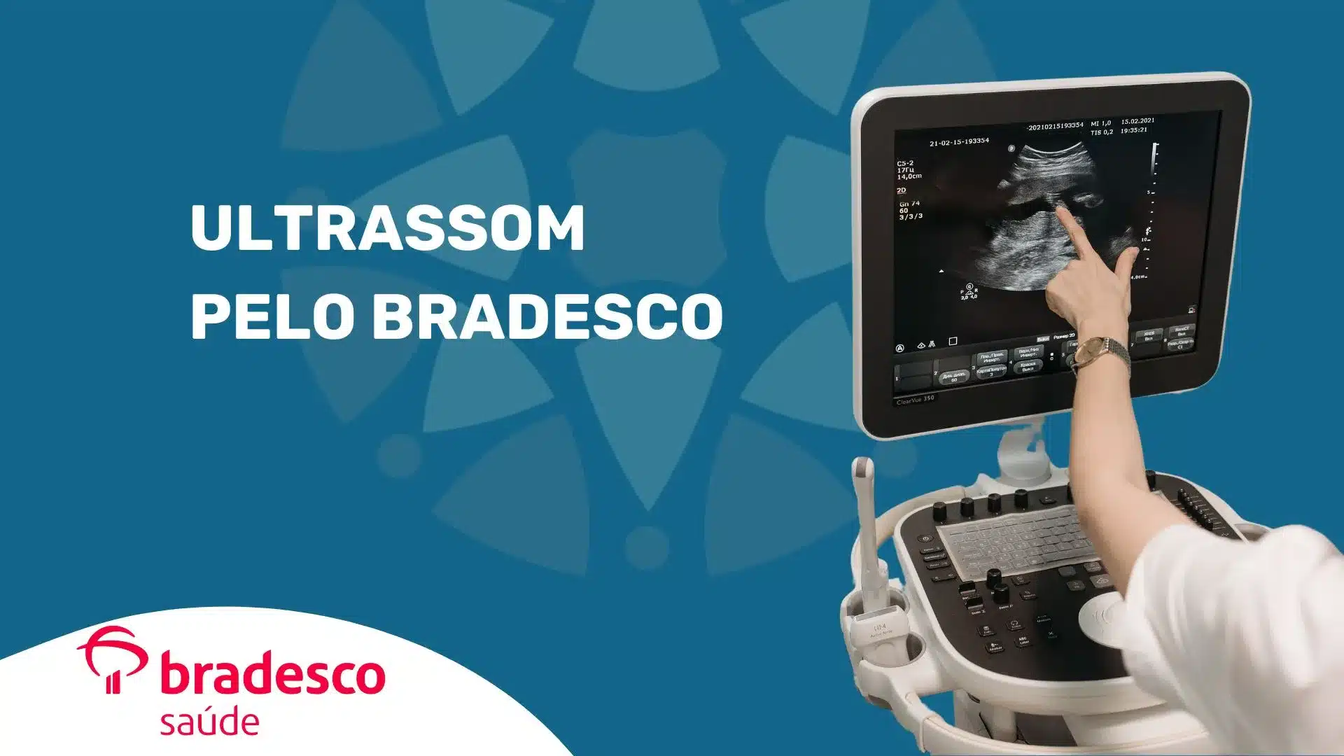 Ultrassonografia pelo Bradesco Saúde em São Paulo 3 Ultrassom com Doppler e ecocardiograma com cobertura Bradesco Saúde em São Paulo – SP, no Instituto Medicina em Foco. Agende sua ultrassonografia na MEF!