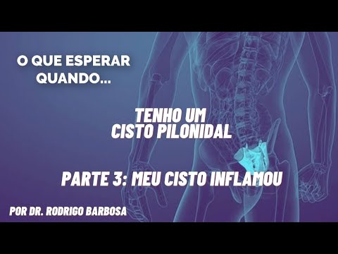 Vídeo