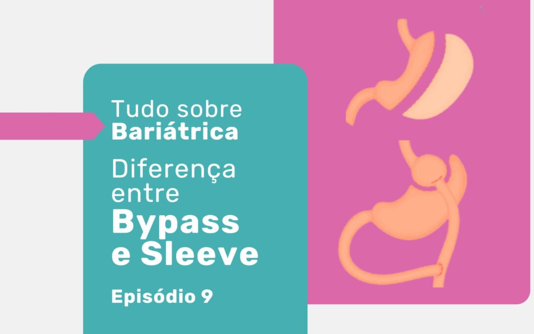 Diferença entre bypass e sleeve: qual a melhor?