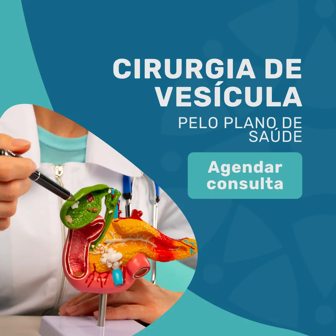 Agende a sua cirurgia de vesícula convênio omint