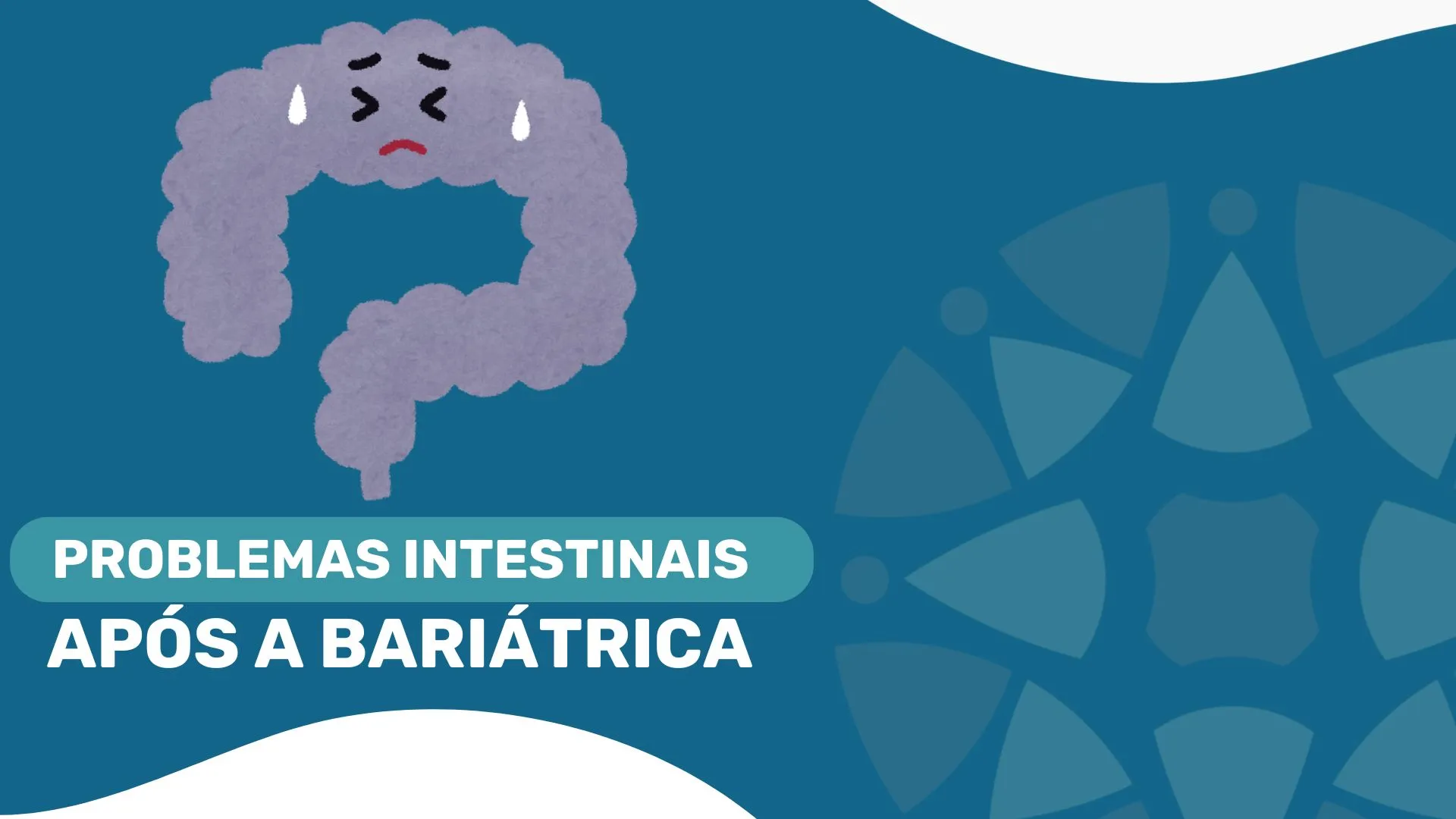 Problemas Intestinais Após Bariátrica - Saiba Tudo com o Dr. Rodrigo Barbosa