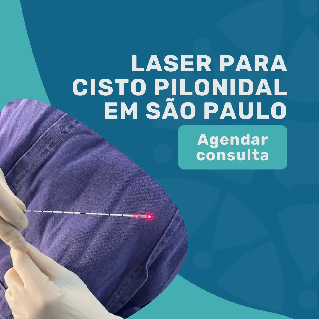 Laser para Cisto Pilonidal em São Paulo