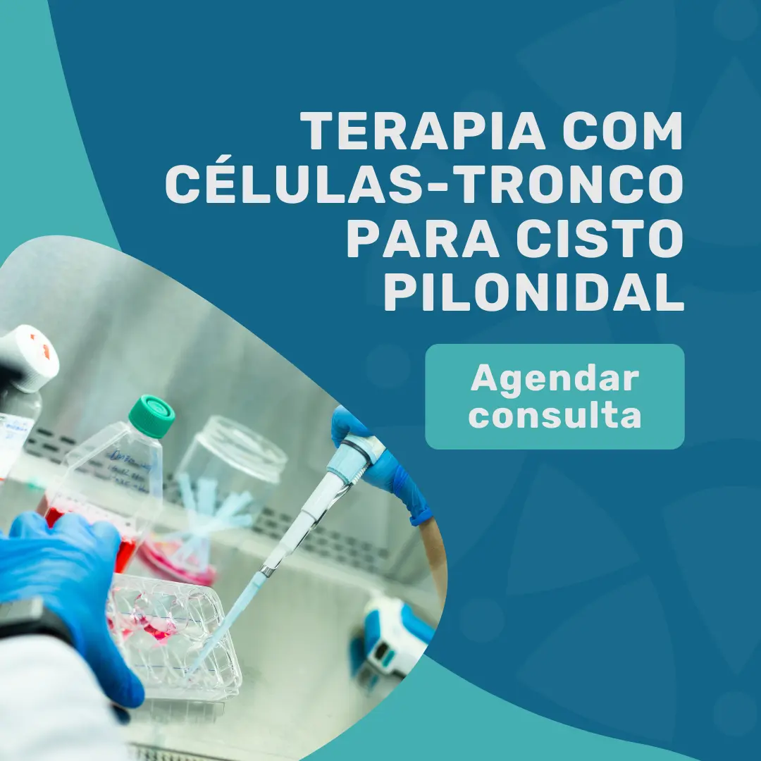 Agende sua consulta e faça o Terapia com células-tronco para Cisto Pilonidal