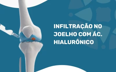 Descubra o Valor de uma Infiltração no Joelho em 2025