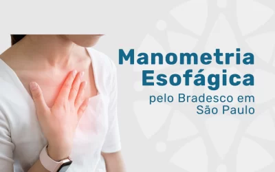 Manometria Esofágica pelo Bradesco em São Paulo
