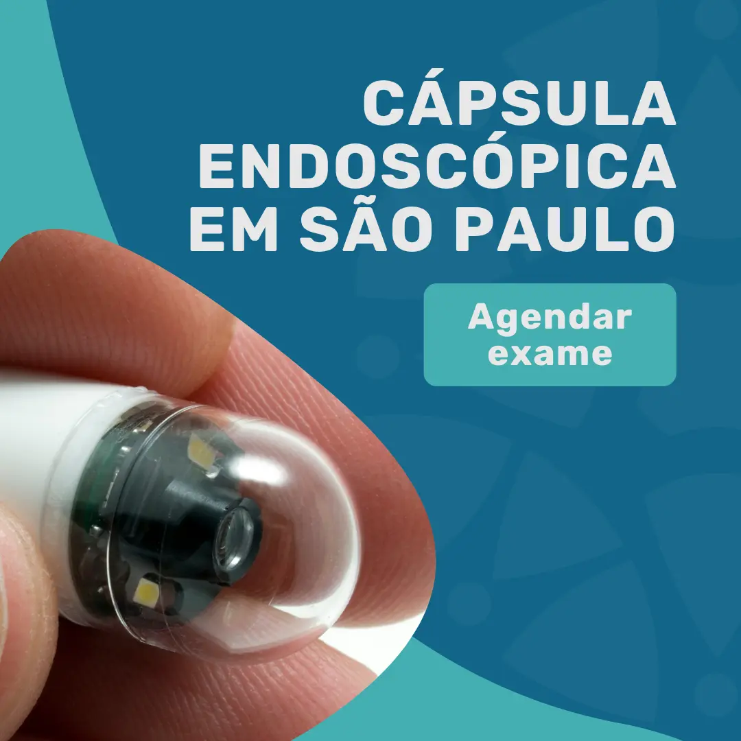 Cápsula Endoscópica preço: R$6.000 em 2026 1 Entre em contato para agendar exame cápsula endoscópica preço em São Paulo