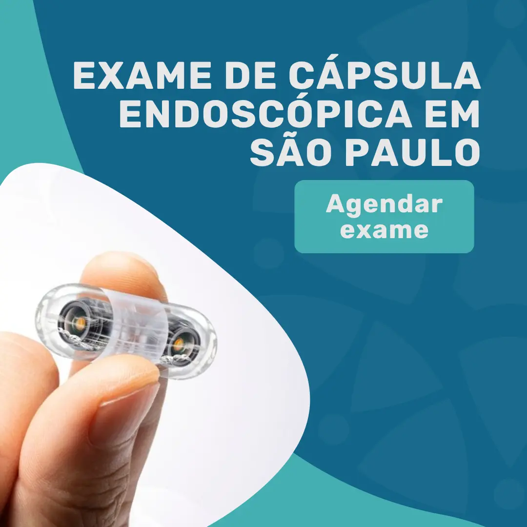 Exame de cápsula endoscópica: agende em SP por R$6.000 4 Entre em contato para agender exame de cápsula endoscópica em São Paulo, Dr Rodrigo Barbosa