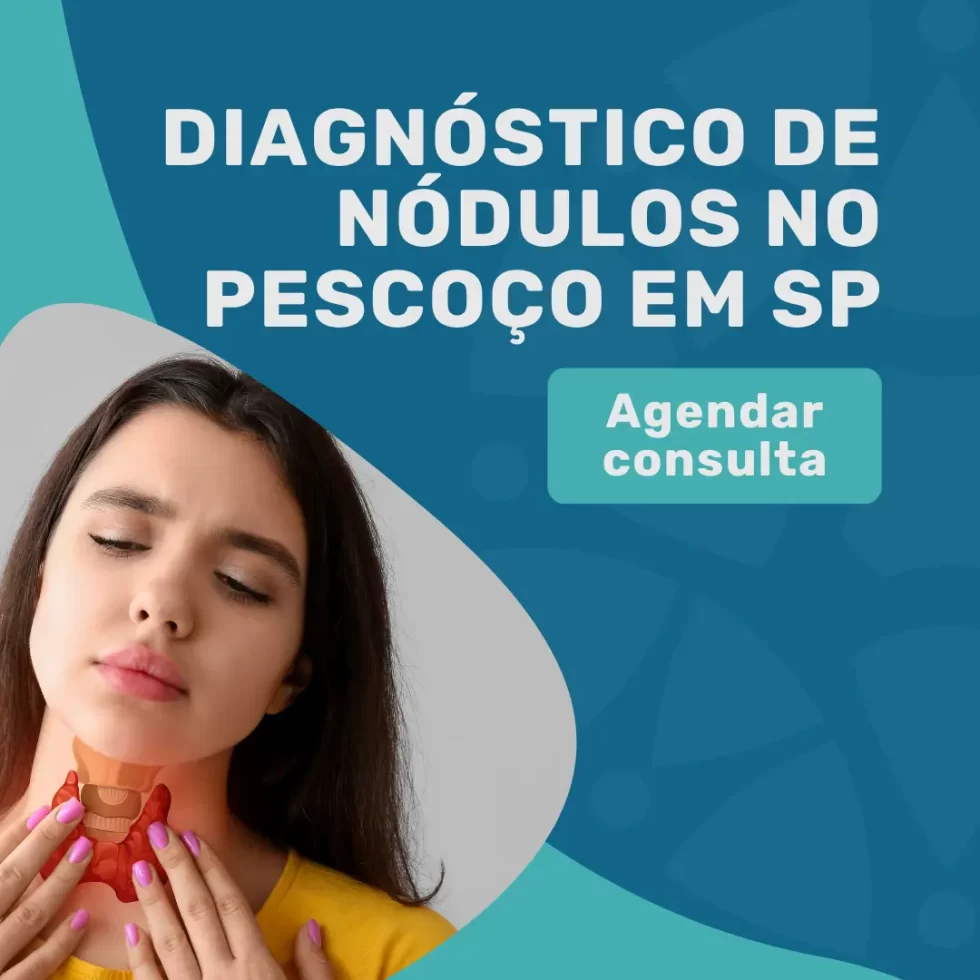 TI-RADS 4: saiba como avaliar o nódulo da tireoide 5 Agende o diagnóstico de nódulos no pescoço com cirurgião de cabeça e pescoço em São Paulo — TI-RADS 4