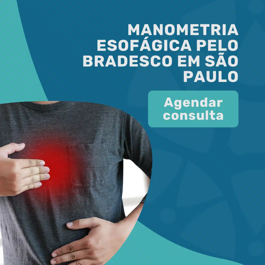 Manometria Esofágica pelo Bradesco em São Paulo 4 Manometria-Esofágica-pelo-Bradesco-em-São-Paulo