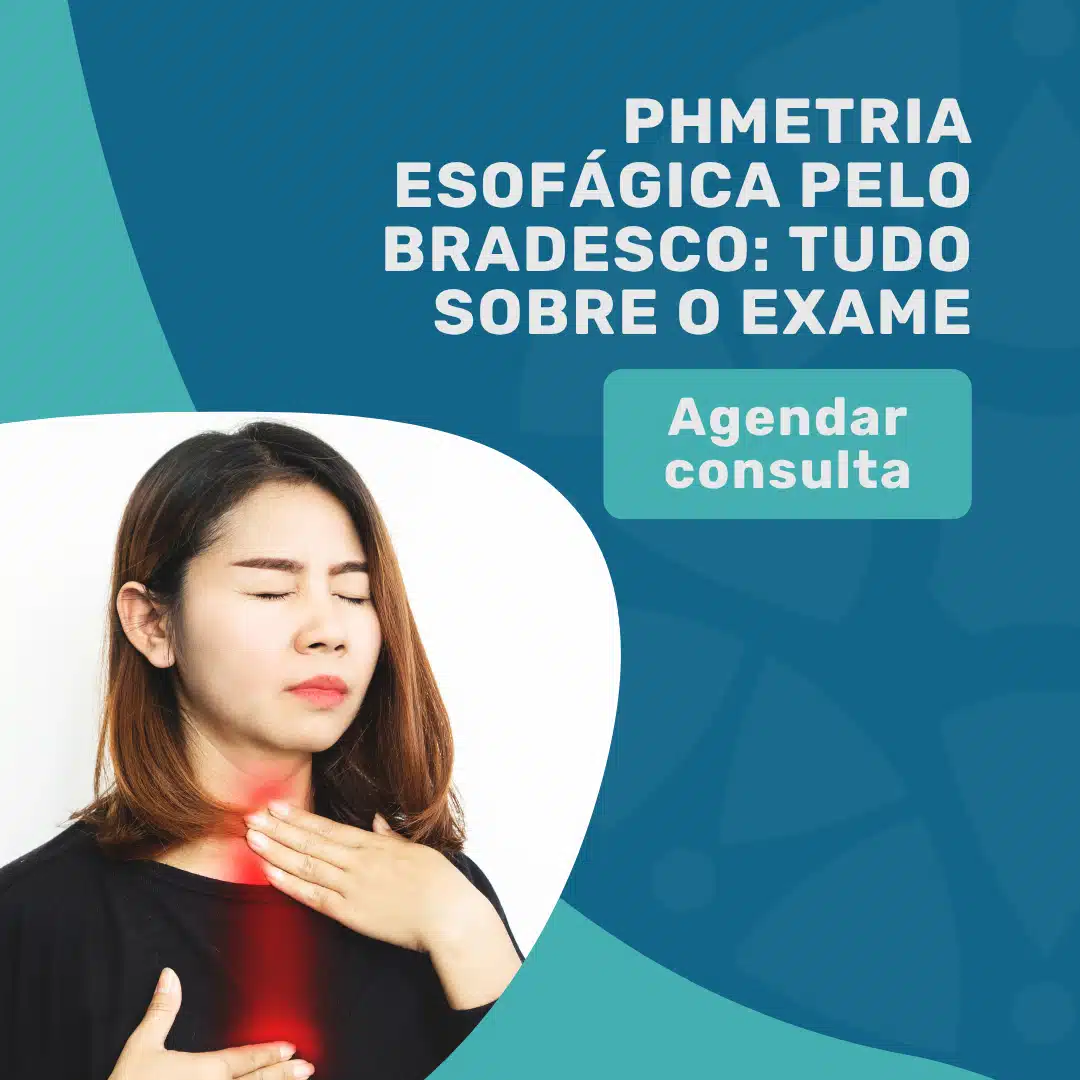 PHmetria Esofágica pelo Bradesco: Tudo sobre o Exame 6 PHmetria-Esofágica-pelo-Bradesco-tudo-sobre-o-exame