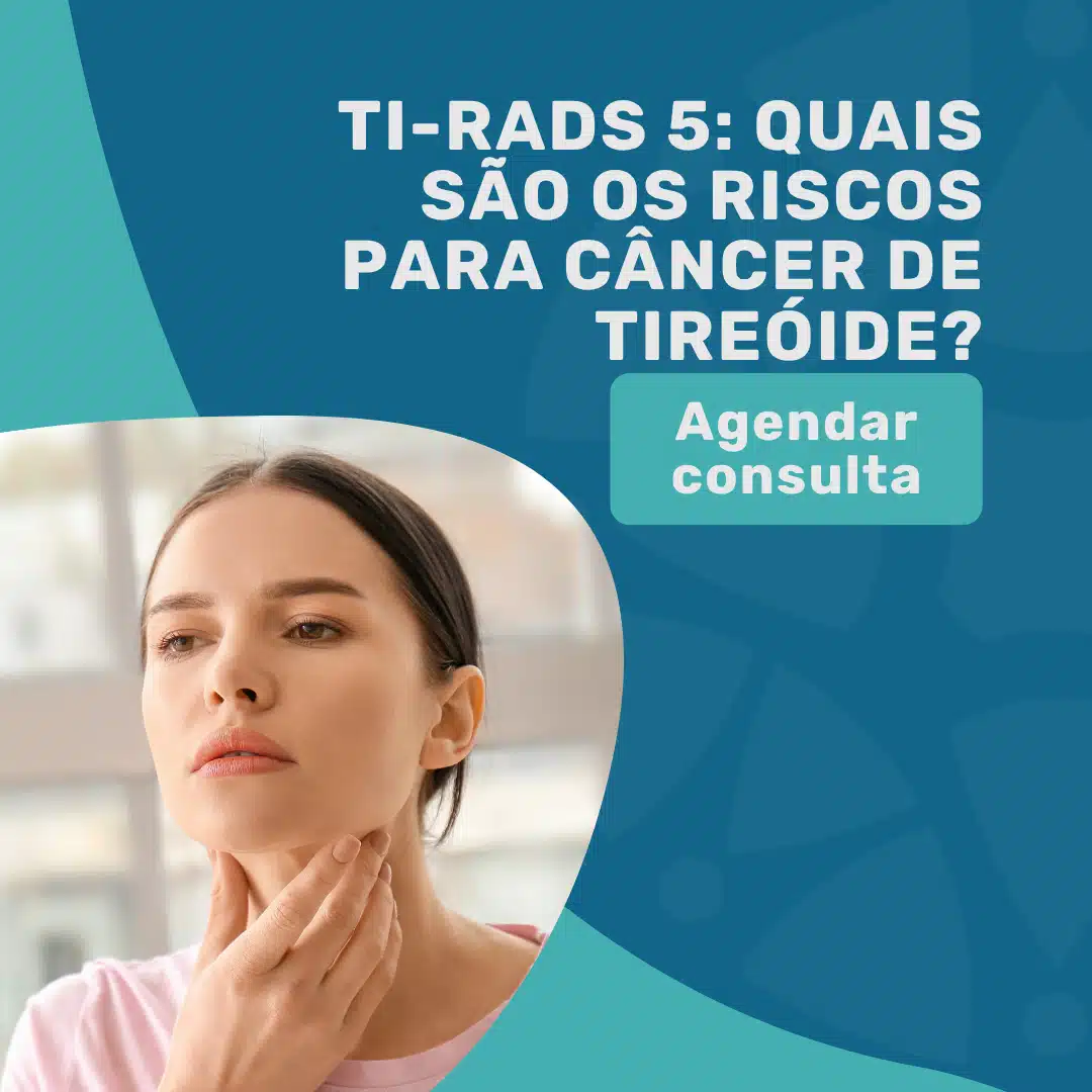 TI-RADS 5: Quais são os riscos para câncer de tireóide? 4 TI-RADS 5