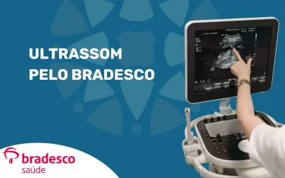 Ultrassonografia pelo Bradesco Saúde em São Paulo