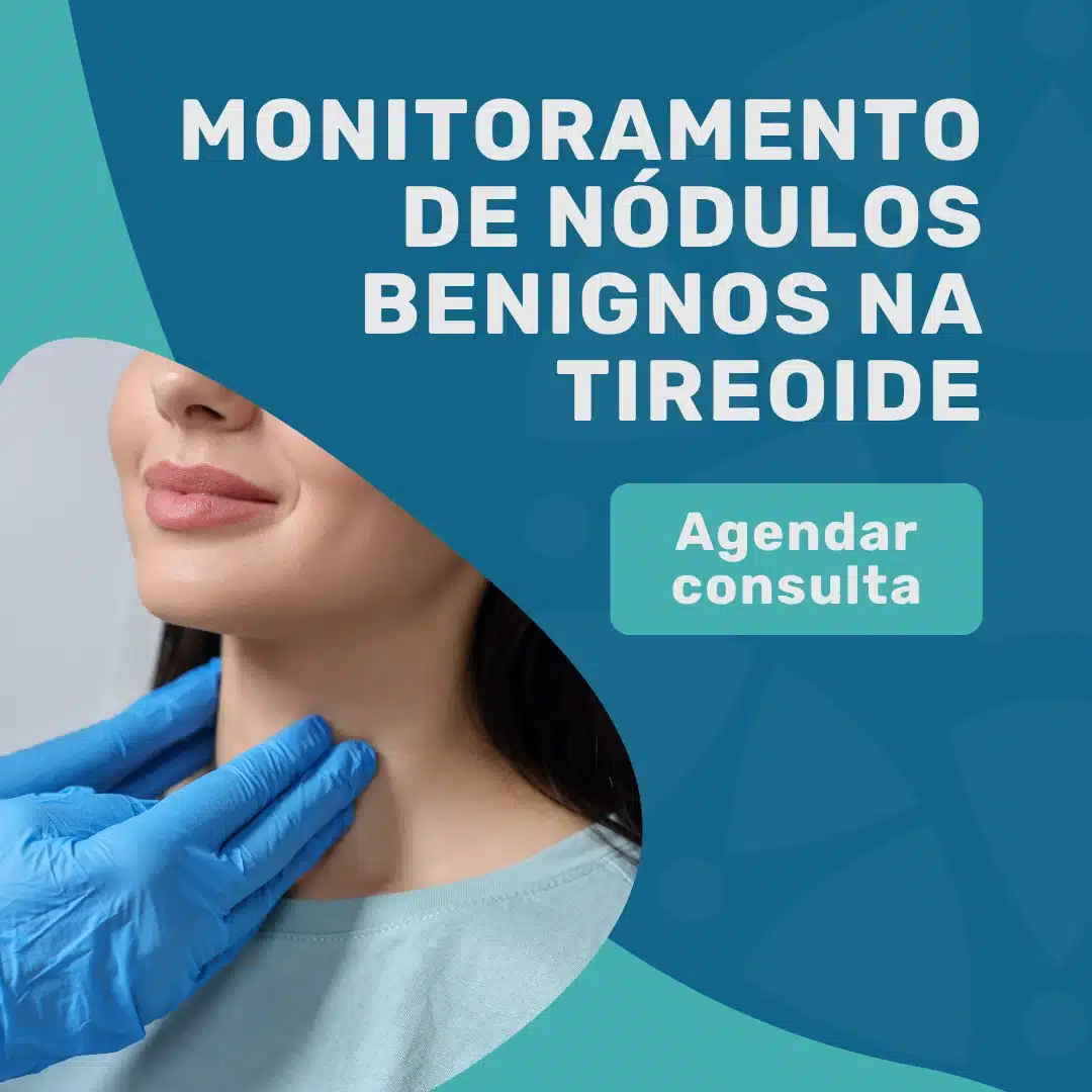 TI-RADS 1 e 2: guia sobre nódulos benignos na tireoide 4 Agende o monitoramento do seu nódulo benigno de tireoide TI-RADS 1 ou 2 em São Paulo