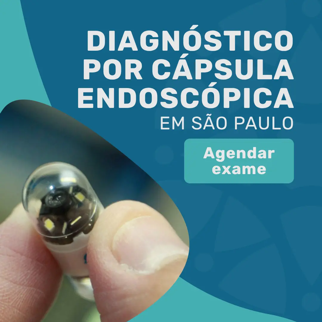 Valor fixo do diagnóstico por Cápsula Endoscópica: R$6.000 2 Entre em contato para ter o seu diagnóstico por cápsula endoscópica em São Paulo no Instituto Medicina em Foco