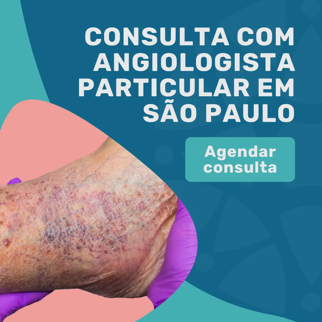 Angiologista Particular: Valor e Como escolher em 2026 4 Entre em contato para mais informações sobre angiologista valor da consulta particular em são paulo