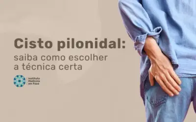 Como escolher a técnica certa para Cisto Pilonidal