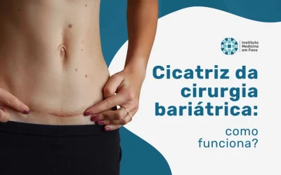 Cicatriz da cirurgia bariátrica: como fica e quanto tempo
