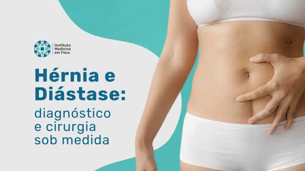 Hérnia e Diástase: Diagnóstico e Cirurgia Sob Medida | Dr. Rodrigo ...