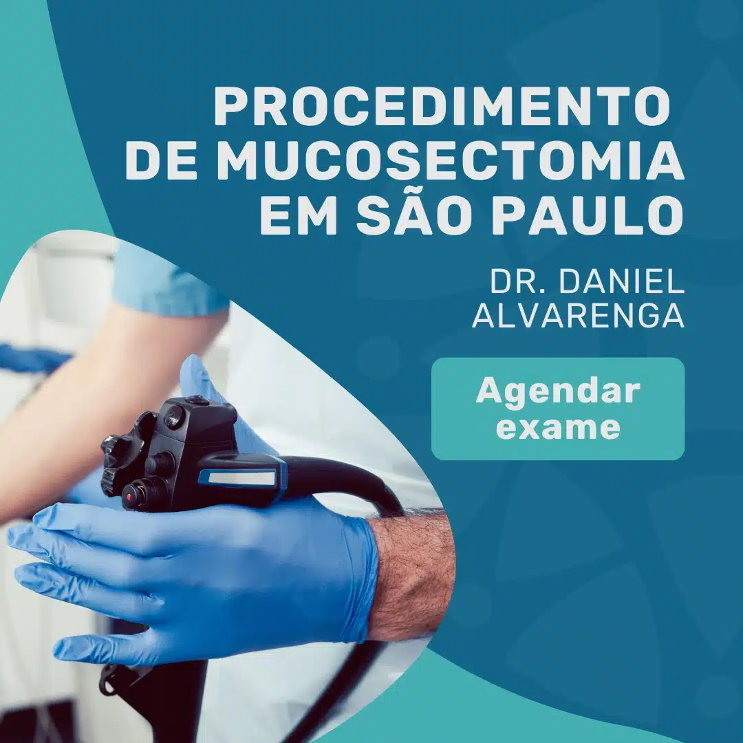 Mucosectomia em São Paulo: onde fazer com segurança? 2 Entre em contato para agendar seu exame de Mucosectomia em São Paulo com o Dr. Daniel Alvarenga