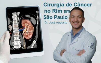 Cirurgia de câncer no rim em São Paulo exige seguimento?