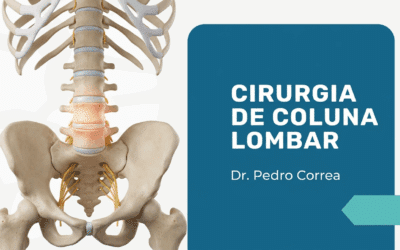 Cirurgia de Coluna Lombar em São Paulo