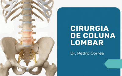 Cirurgia de Coluna Lombar em São Paulo