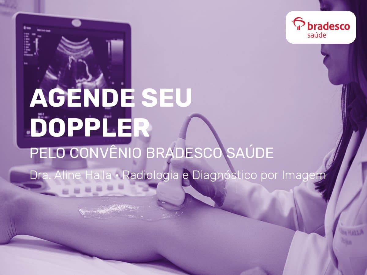 Doppler de membros inferiores pelo convênio Bradesco Saúde em São Paulo · Equipe Dr. Rodrigo Barbosa 2 Agende seu doppler de membros inferiores pelo Bradesco Saúde com o grupo de ultrassonografia da equipe do Dr. Rodrigo Barbosa