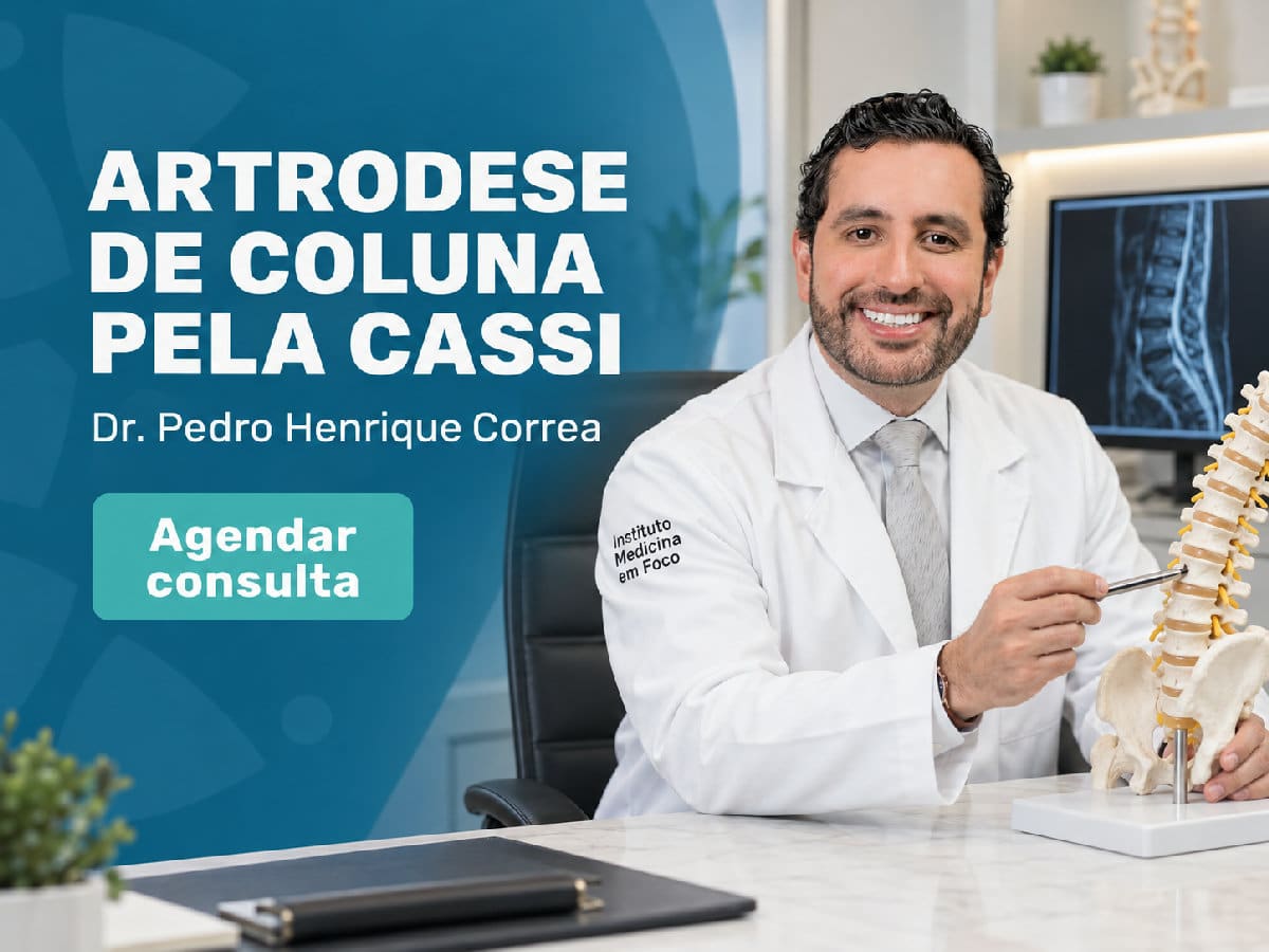 Artrodese de coluna pela Cassi 4 Imagem ilustrativa — artrodese de coluna pela Cassi
