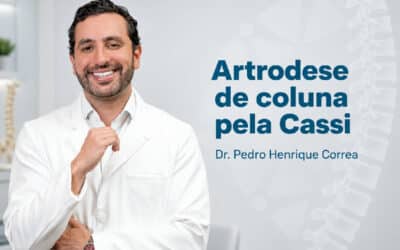 Artrodese de coluna pela Cassi