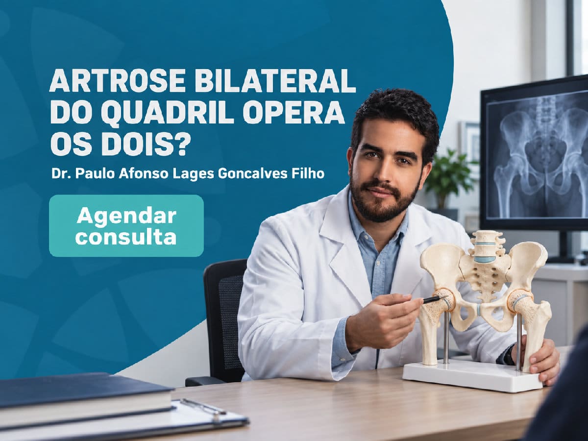 Artrose bilateral do quadril: opera os dois? 4 Imagem ilustrativa — artrose bilateral do quadril: opera os dois?