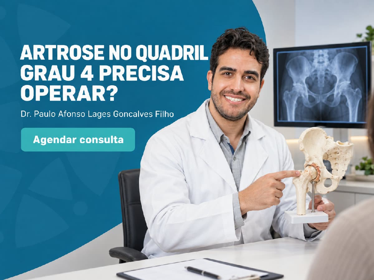 Artrose no quadril grau 4: precisa operar? 4 Imagem ilustrativa — artrose no quadril grau 4: precisa operar?
