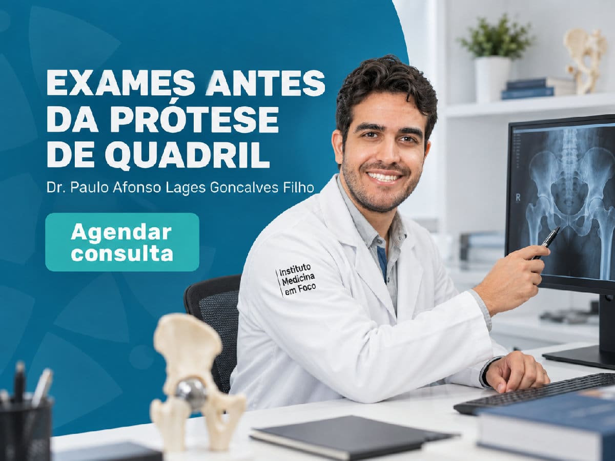 Exames antes da prótese de quadril 4 Imagem ilustrativa — exames antes da prótese de quadril