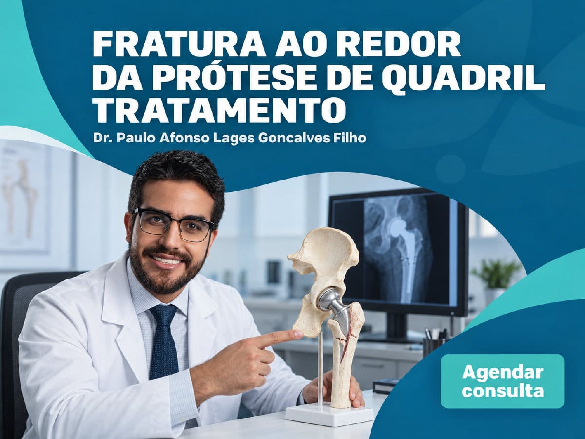 Fratura ao redor da prótese de quadril: tratamento 4 Imagem ilustrativa — fratura ao redor da prótese de quadril: tratamento