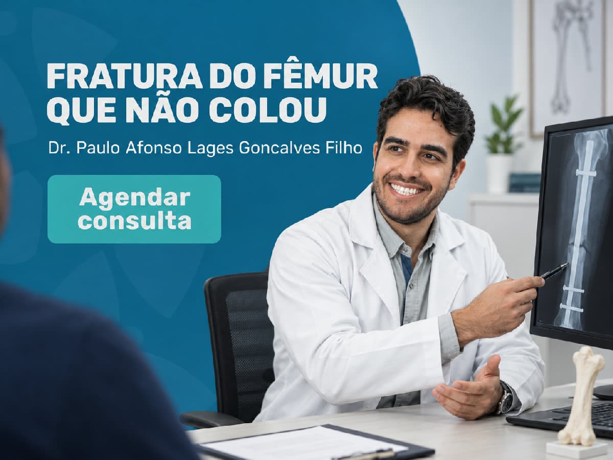 Fratura do fêmur que não colou: o que fazer 4 Imagem ilustrativa — fratura do fêmur que não colou: o que fazer