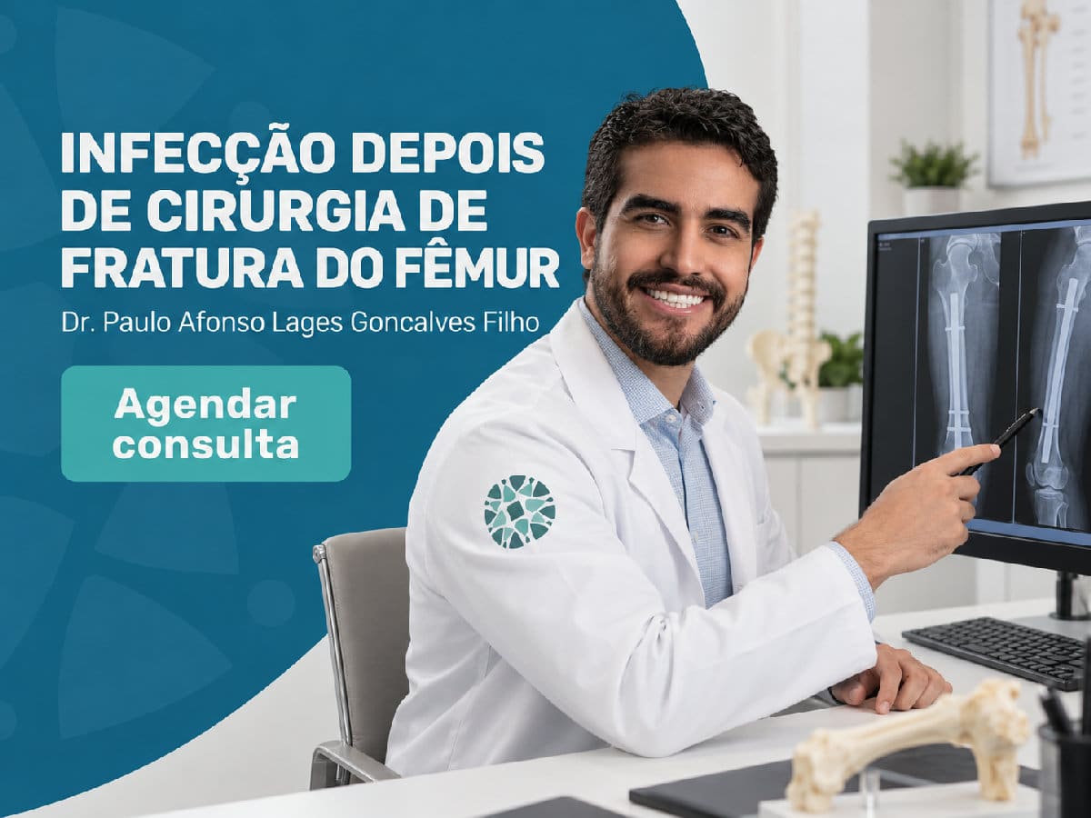 Infecção depois de cirurgia de fratura do fêmur | São Paulo 4 Imagem ilustrativa — infecção depois de cirurgia de fratura do fêmur