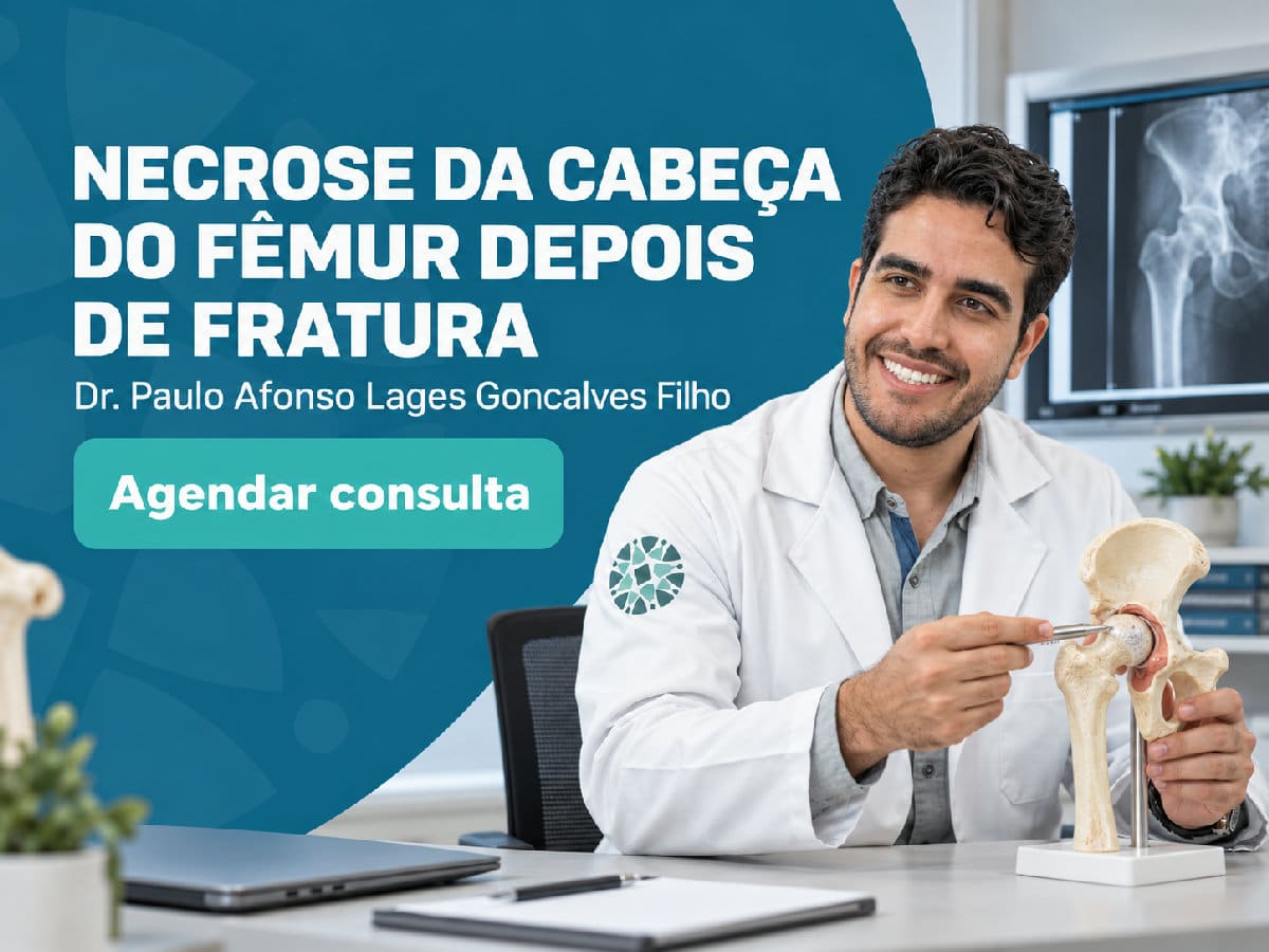 Dr. Paulo Afonso Lages Goncalves Filho em atendimento clínico — necrose da cabeça do fêmur depois de fratura