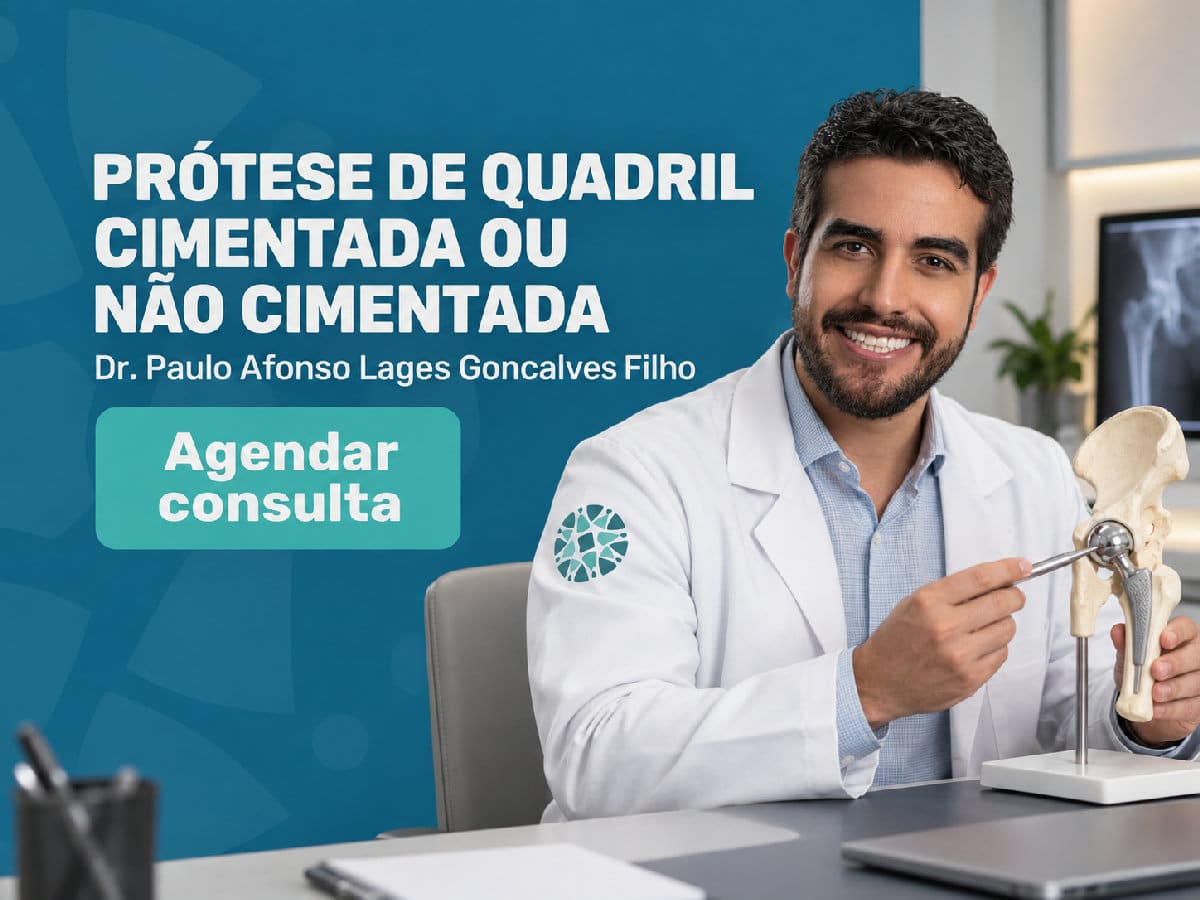 Prótese de quadril: cimentada ou não cimentada 4 Imagem ilustrativa — prótese de quadril: cimentada ou não cimentada