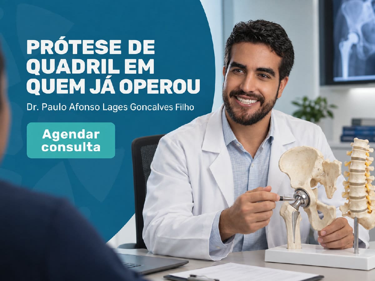Prótese de quadril em quem já operou a coluna 4 Imagem ilustrativa — prótese de quadril em quem já operou a coluna