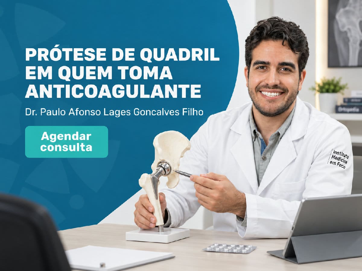 Prótese de quadril em quem toma anticoagulante 4 Imagem ilustrativa — prótese de quadril em quem toma anticoagulante