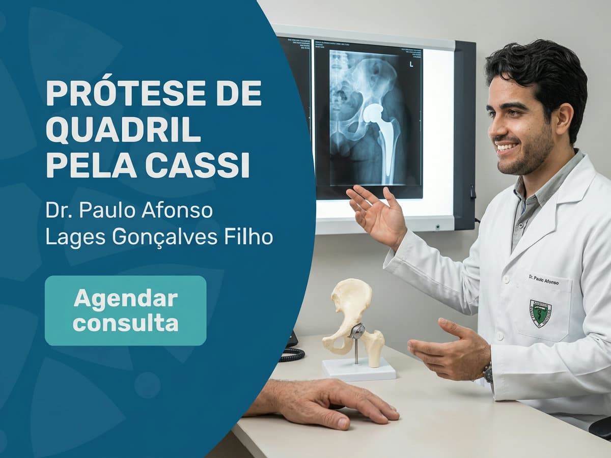 Prótese de quadril pela Cassi 4 Imagem ilustrativa — prótese de quadril pela Cassi
