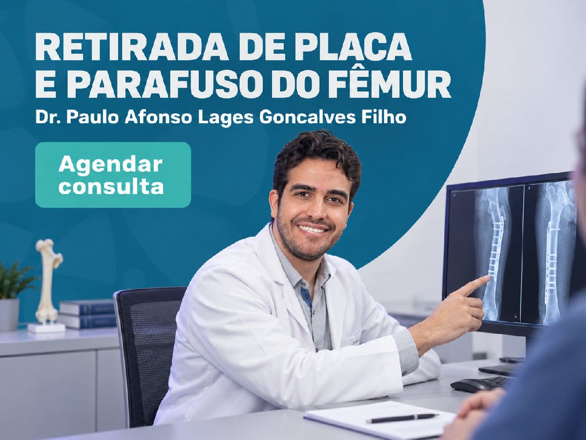 Retirada de placa e parafuso do fêmur: quando fazer 4 Imagem ilustrativa — retirada de placa e parafuso do fêmur: quando fazer
