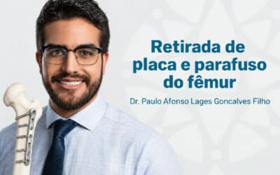 Home 8 Retirada de placa e parafuso do fêmur: quando fazer